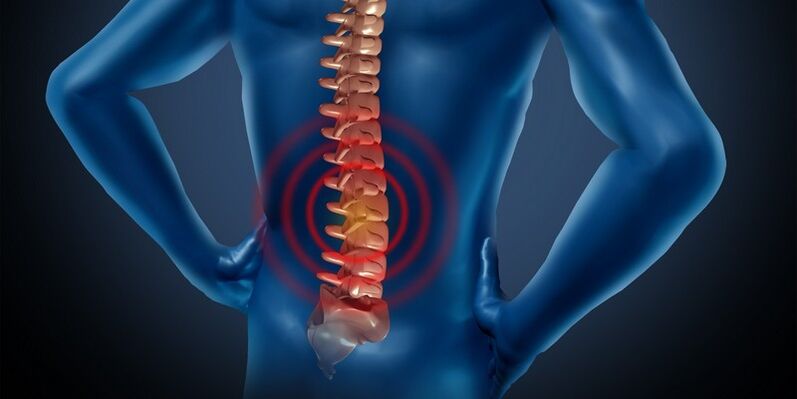 Οστεοχονδρία της οσφυϊκής περιοχής